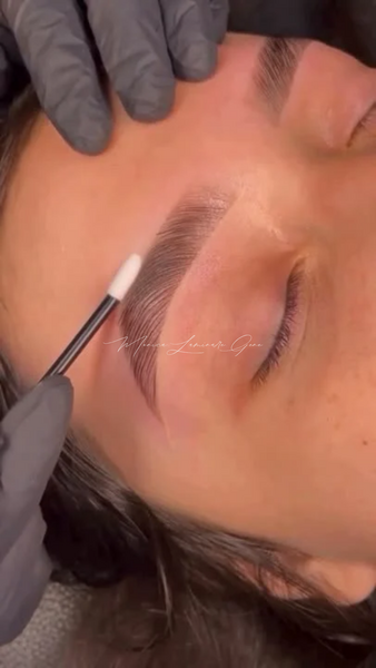 Laminare gene si sprancene.