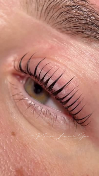 Laminare gene si sprancene.