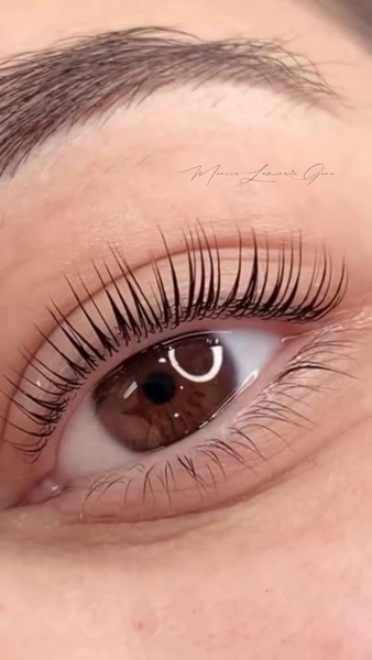 Laminare gene si sprancene.