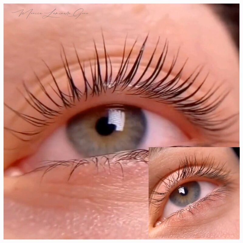 Laminare gene si sprancene.