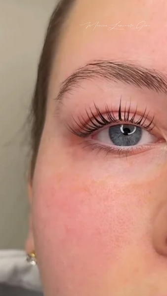 Laminare gene si sprancene.