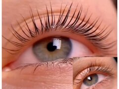 Laminare gene si sprancene